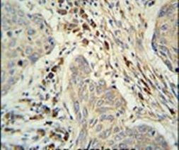 KXD1 Antibody in Immunohistochemistry (IHC)