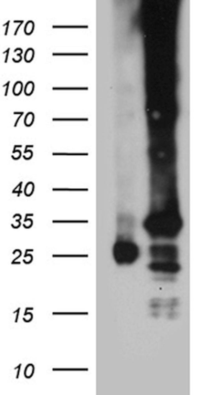 C19orf52 Antibody in Western Blot (WB)