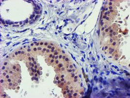 C1S Antibody in Immunohistochemistry (Paraffin) (IHC (P))