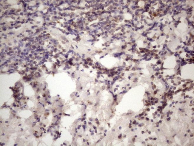C1orf106 Antibody in Immunohistochemistry (Paraffin) (IHC (P))