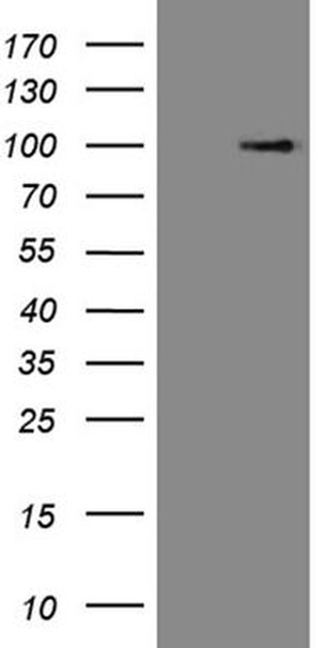 C1orf106 Antibody in Western Blot (WB)