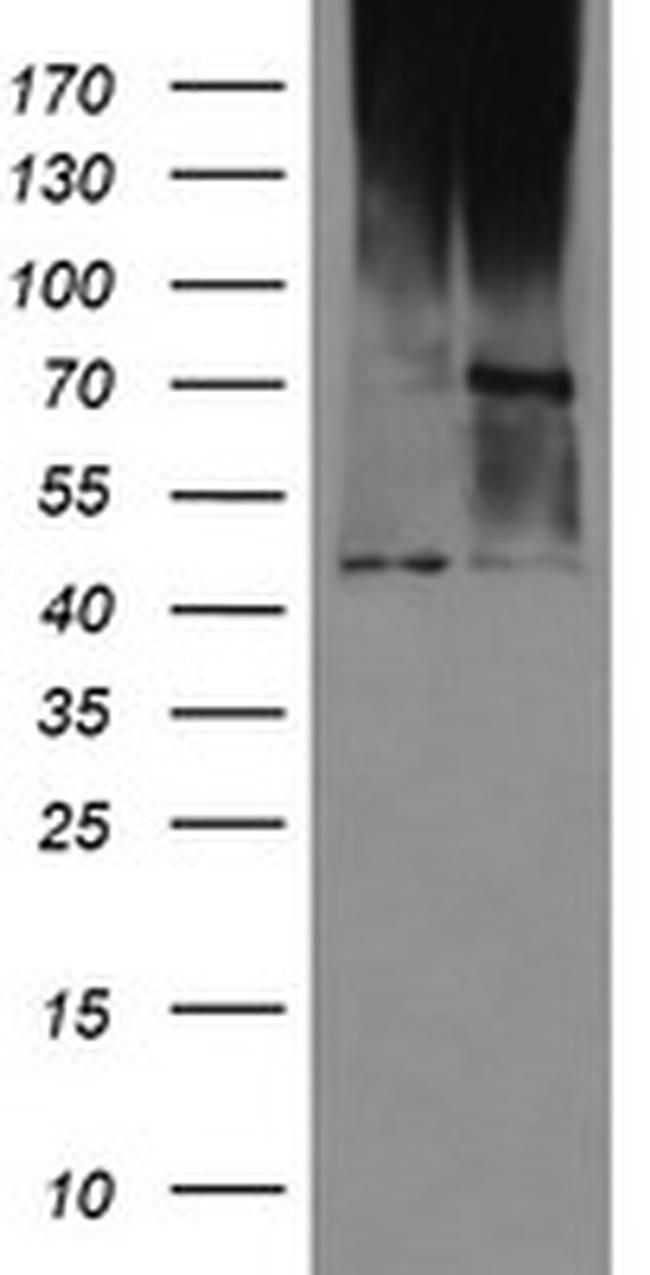C1orf161 Antibody in Western Blot (WB)