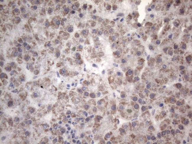 C2 Antibody in Immunohistochemistry (Paraffin) (IHC (P))