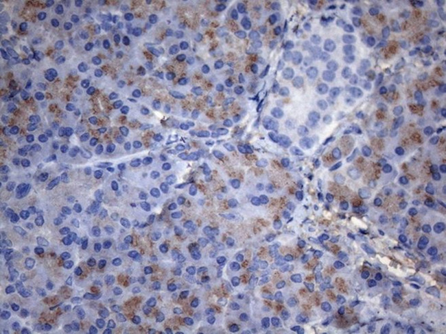 C2 Antibody in Immunohistochemistry (Paraffin) (IHC (P))
