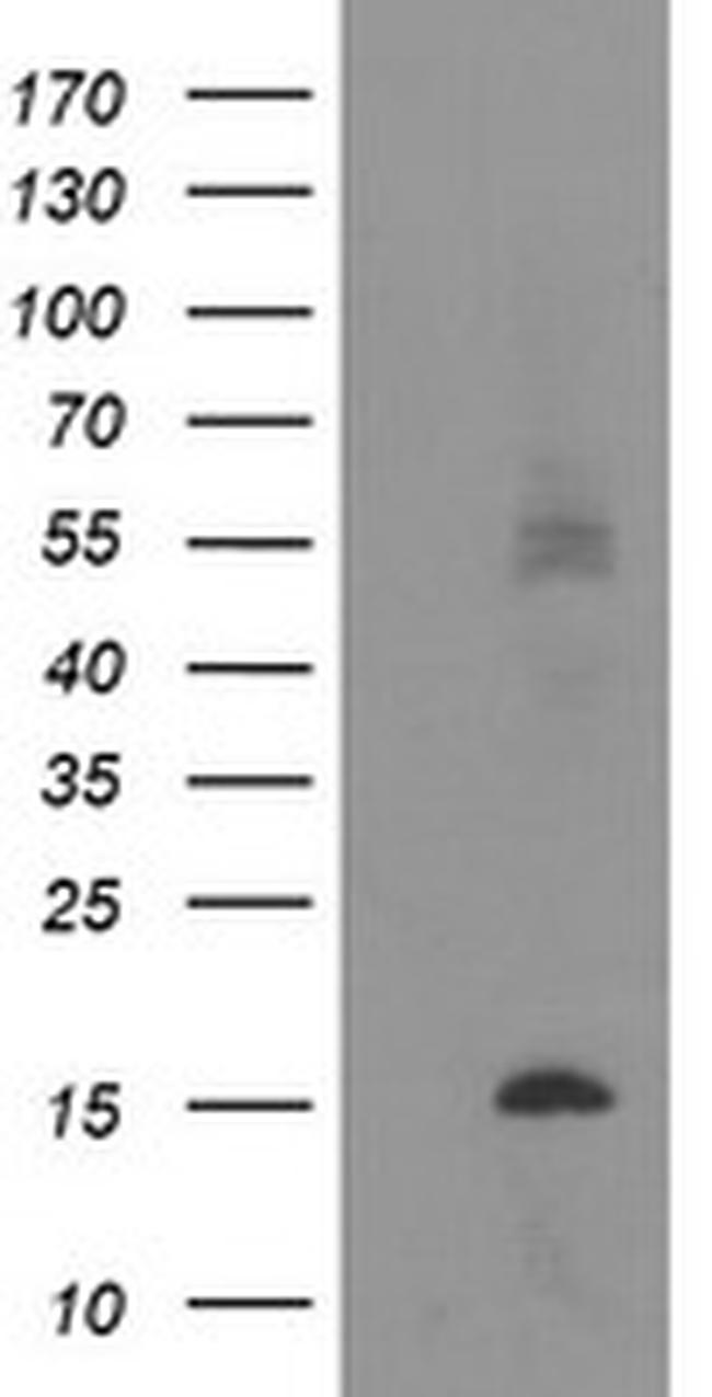 C20orf30 Antibody in Western Blot (WB)