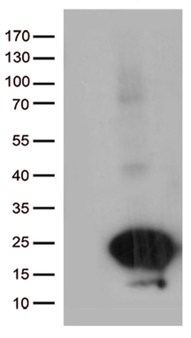C20orf79 Antibody in Western Blot (WB)