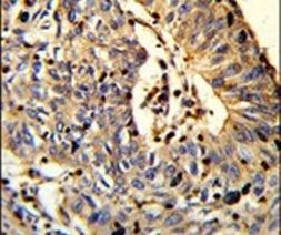 TSPEAR Antibody in Immunohistochemistry (IHC)