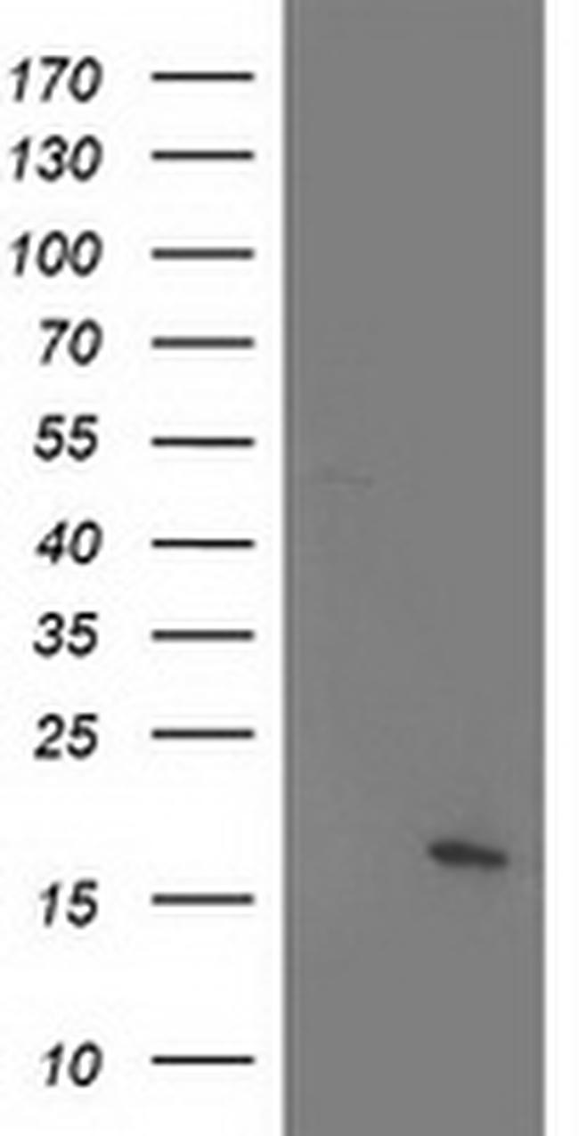 C21orf34 Antibody in Western Blot (WB)