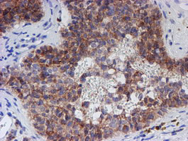 C21orf56 Antibody in Immunohistochemistry (Paraffin) (IHC (P))