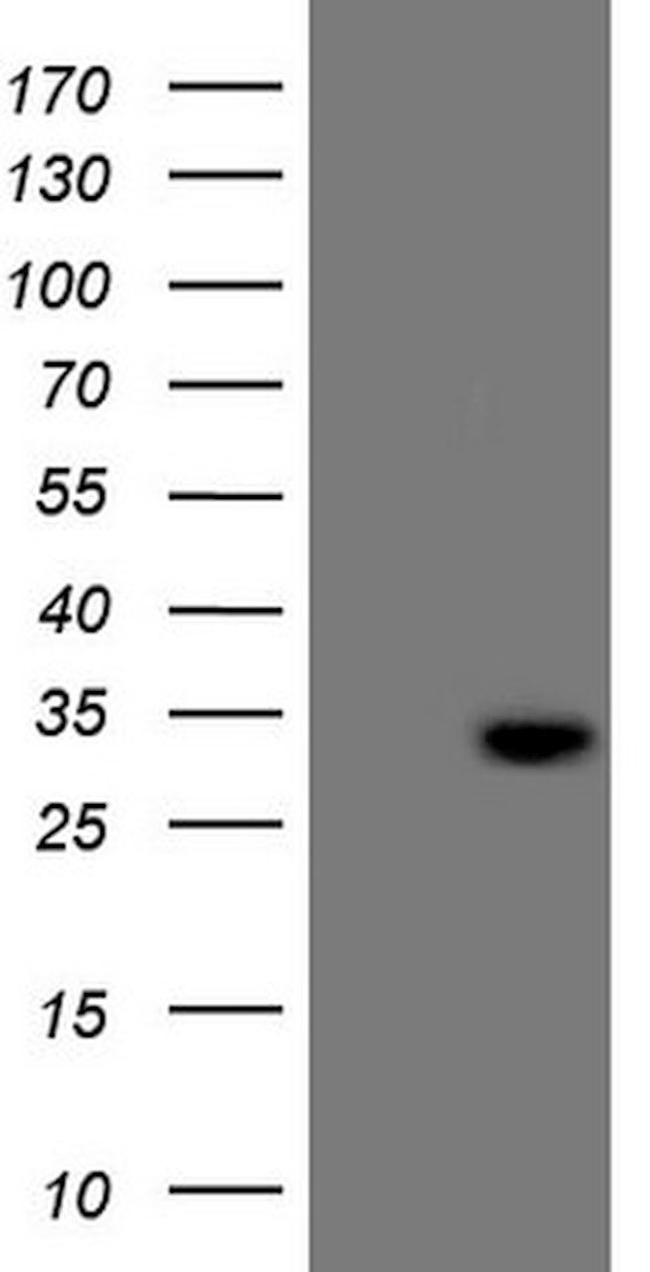 C21orf62 Antibody in Western Blot (WB)