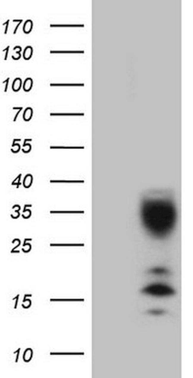 C21orf62 Antibody in Western Blot (WB)