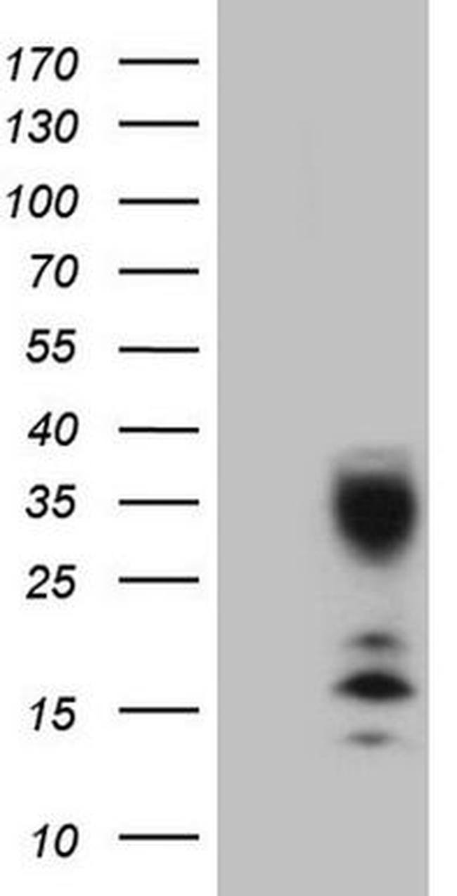 C21orf62 Antibody in Western Blot (WB)