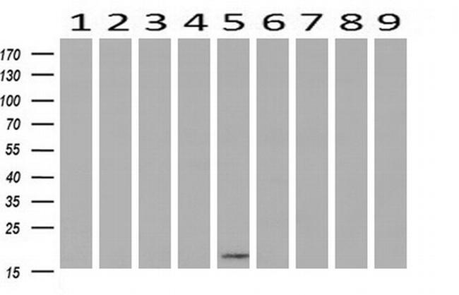 C2orf40 Antibody in Western Blot (WB)