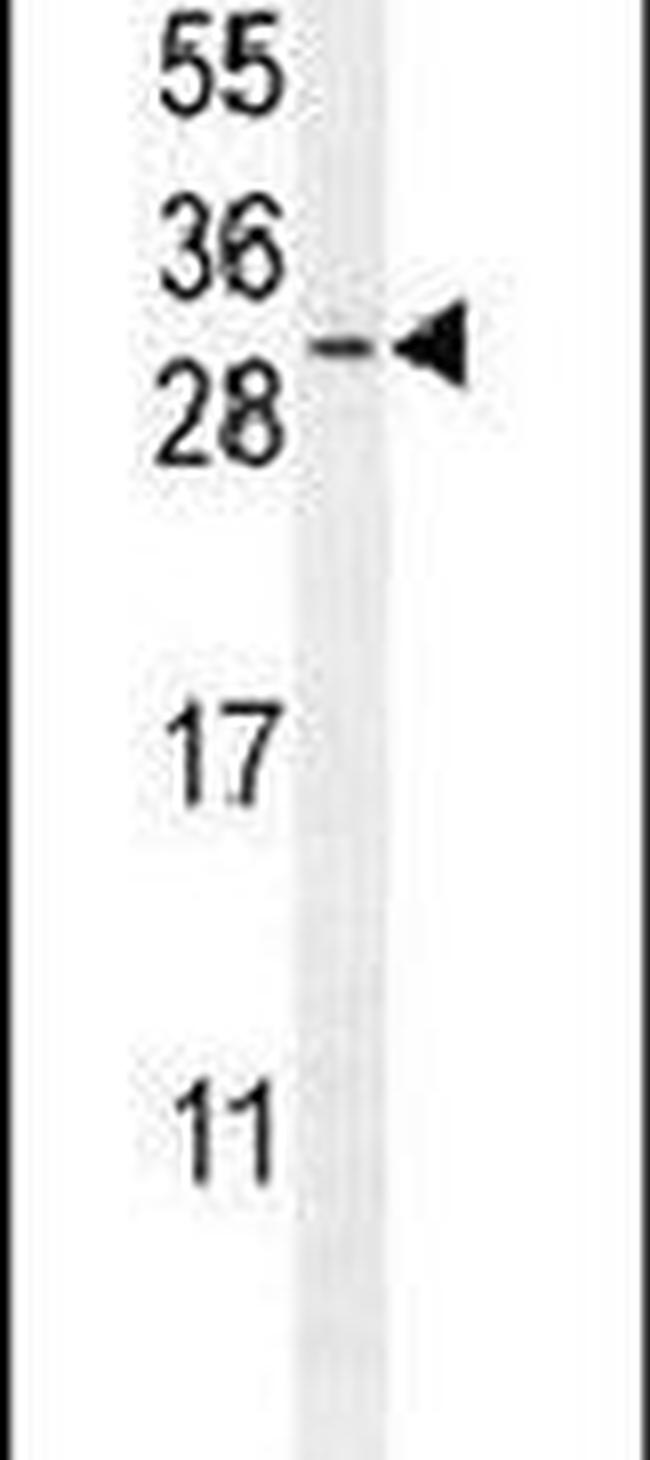 TEX37 Antibody in Western Blot (WB)