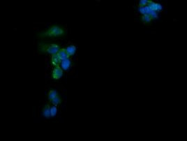C2orf62 Antibody in Immunocytochemistry (ICC/IF)