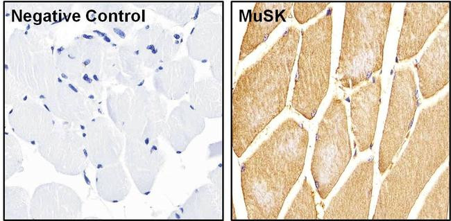 Rabbit IgG (H+L) Secondary Antibody in Immunohistochemistry (Paraffin) (IHC (P))