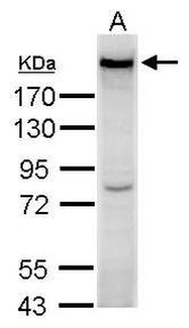 Complement C3 Antibody in Western Blot (WB)