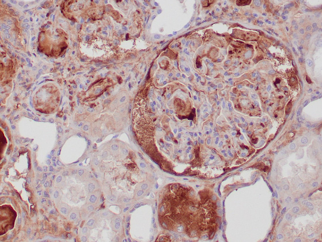 C3d Antibody in Immunohistochemistry (Paraffin) (IHC (P))