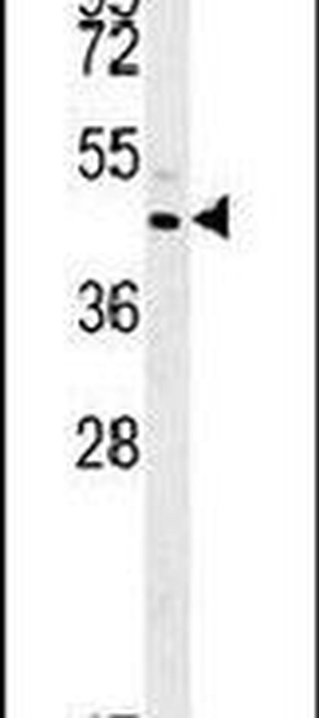 C3orf31 Antibody in Western Blot (WB)