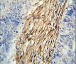 C3orf75 Antibody in Immunohistochemistry (IHC)