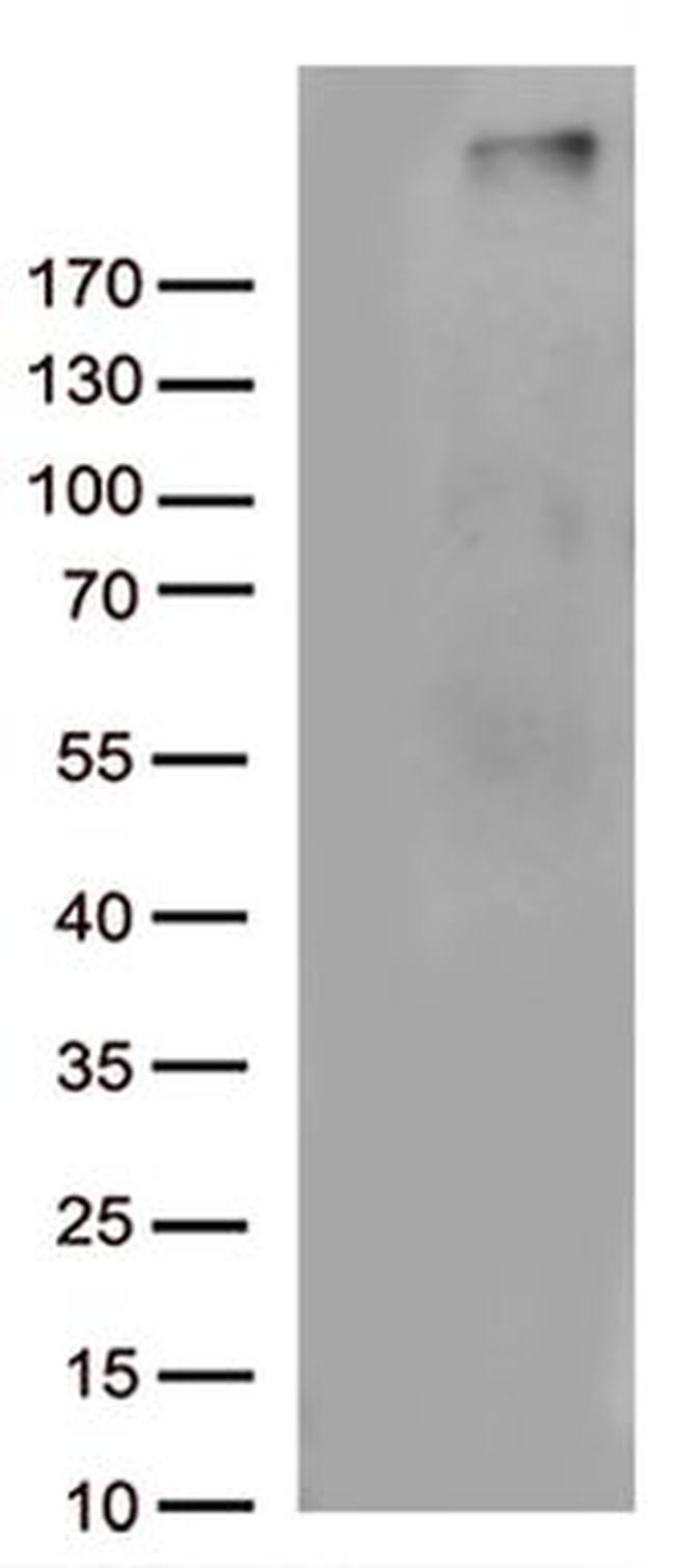 C4B Antibody in Western Blot (WB)