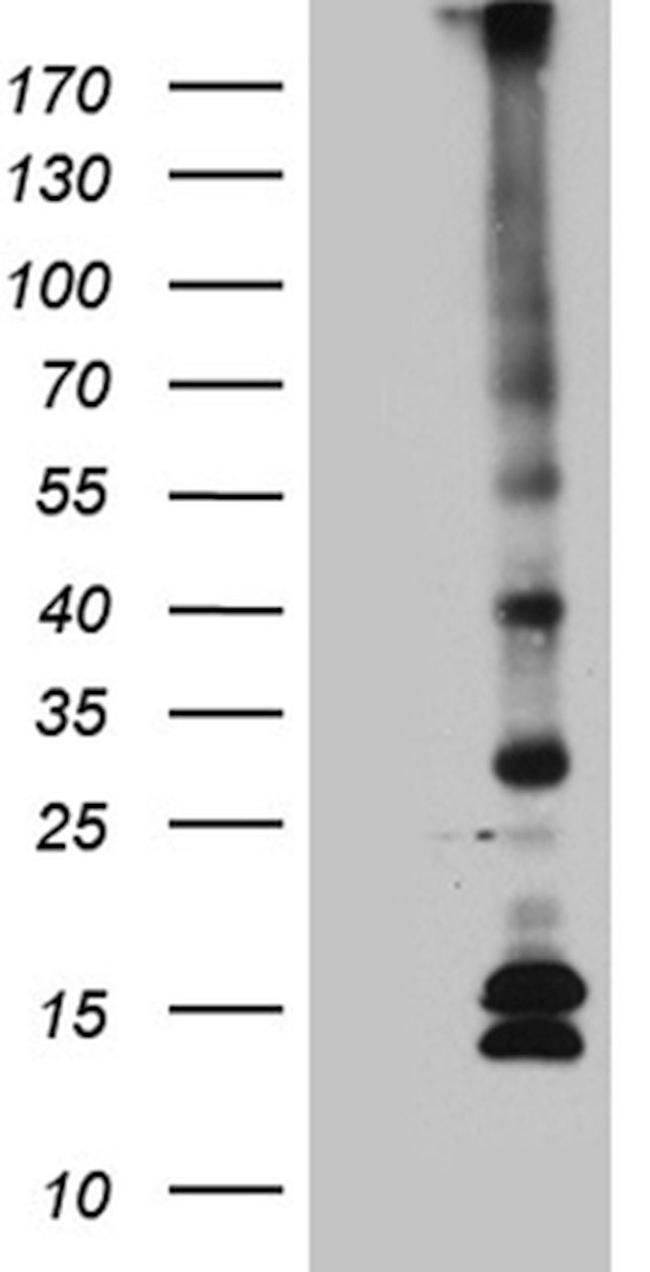 C5orf56 Antibody in Western Blot (WB)