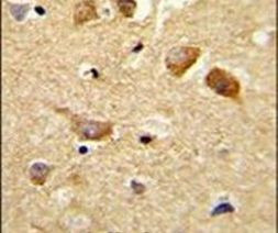 C6orf170 Antibody in Immunohistochemistry (IHC)