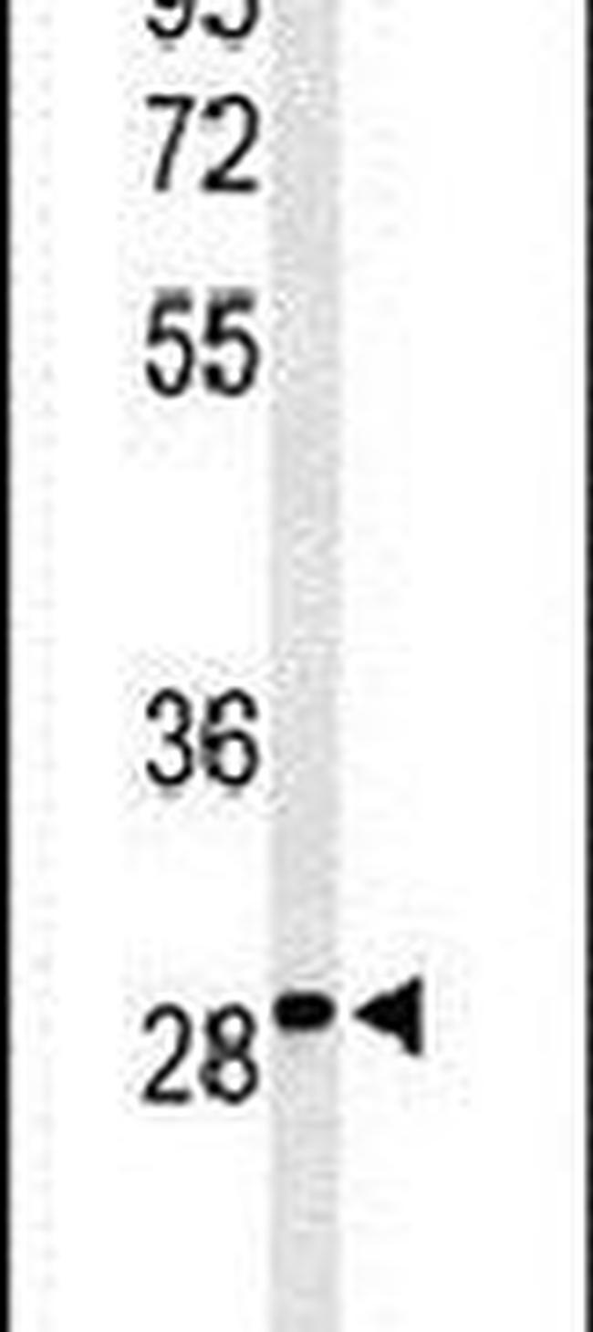 C9orf95 Antibody in Western Blot (WB)