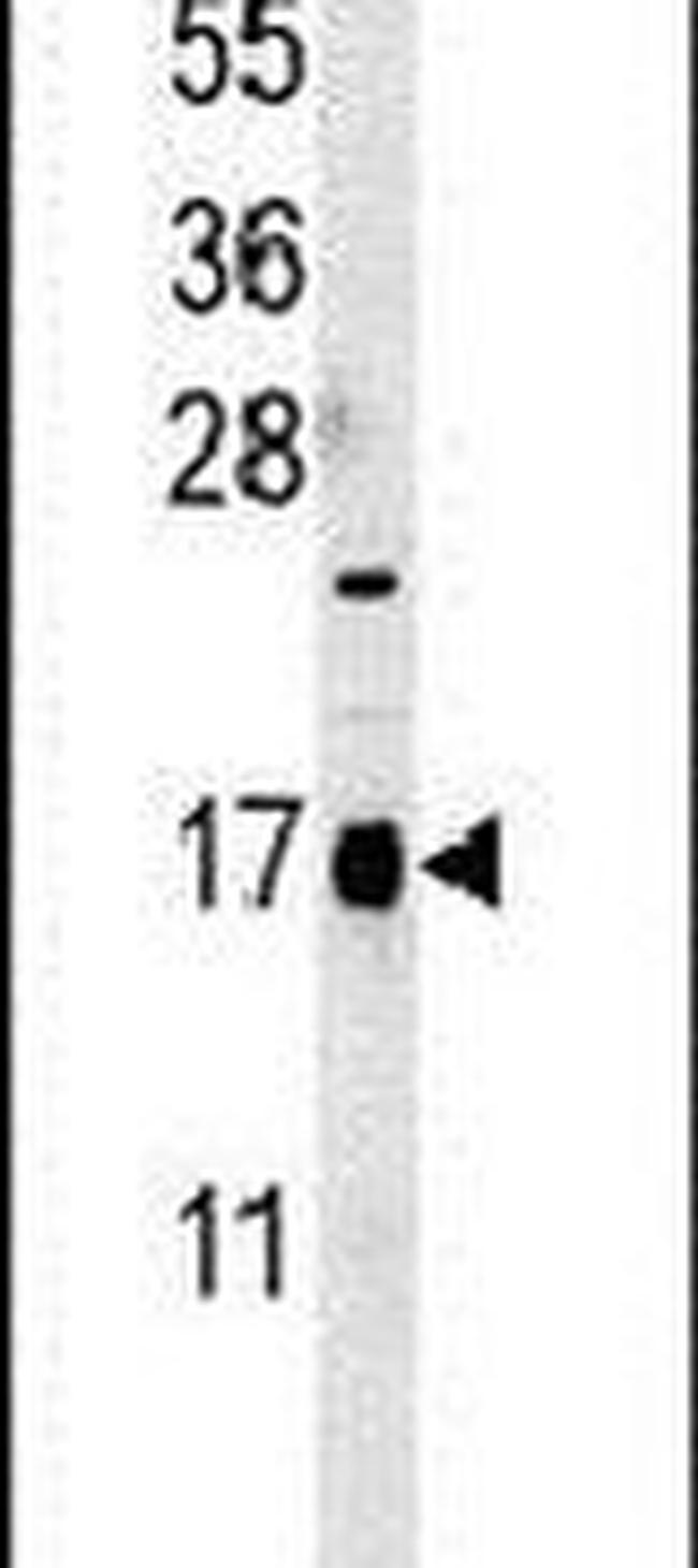 CA095 Antibody in Western Blot (WB)