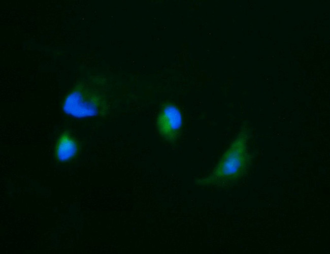 CA12 Antibody in Immunocytochemistry (ICC/IF)