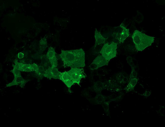 CA12 Antibody in Immunocytochemistry (ICC/IF)