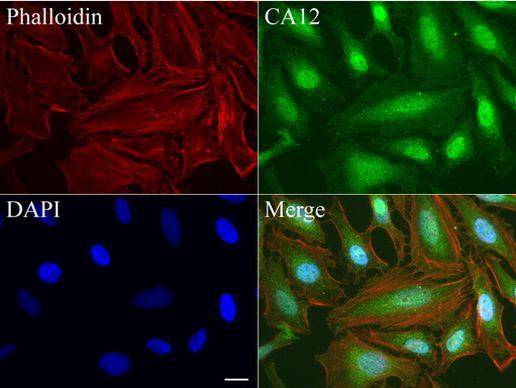 CA12 Antibody in Immunocytochemistry (ICC/IF)