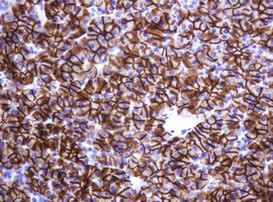 CA12 Antibody in Immunohistochemistry (Paraffin) (IHC (P))