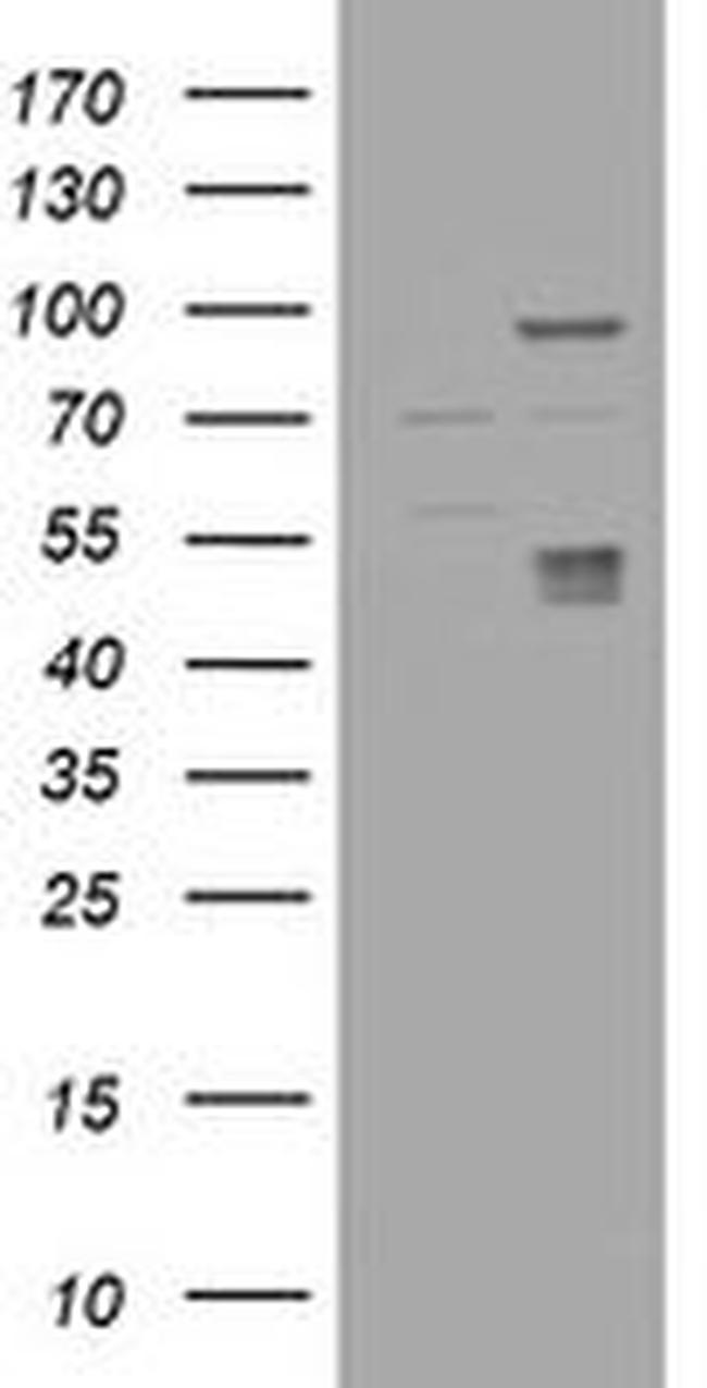 CA12 Antibody in Western Blot (WB)
