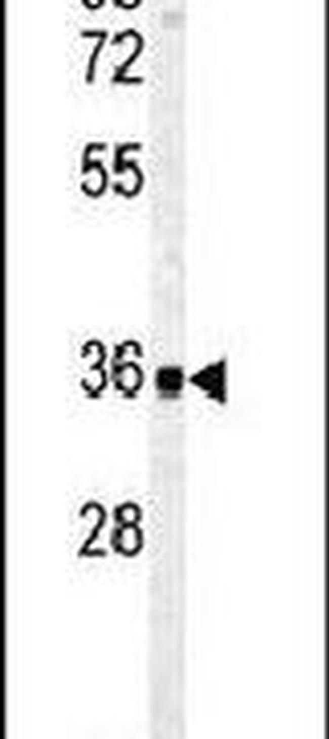 Carbonic Anhydrase IV Antibody in Western Blot (WB)