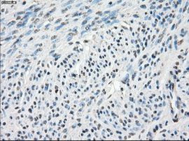 CA9 Antibody in Immunohistochemistry (Paraffin) (IHC (P))
