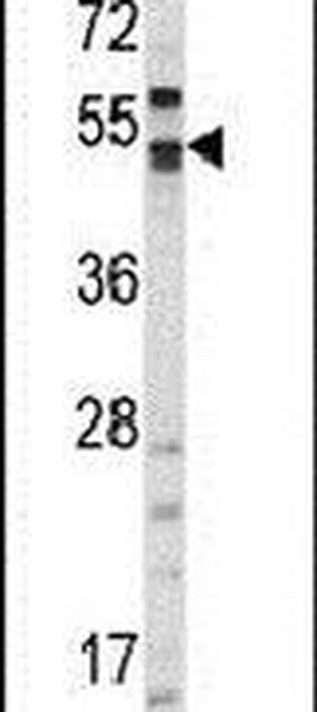 Carbonic Anhydrase IX Antibody in Western Blot (WB)