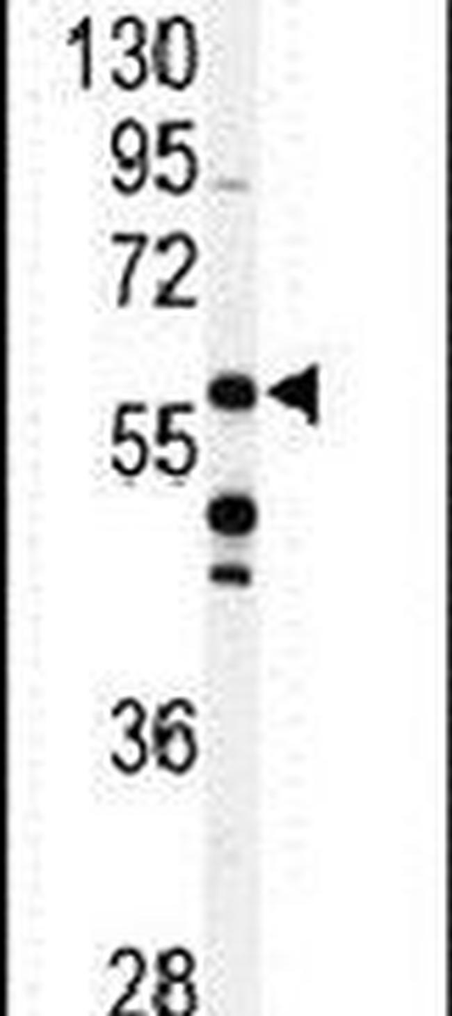 CABC1 Antibody in Western Blot (WB)