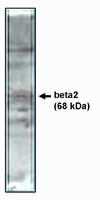 CACNB2 Antibody in Western Blot (WB)
