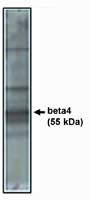 Calcium Channel beta-4 Antibody in Western Blot (WB)