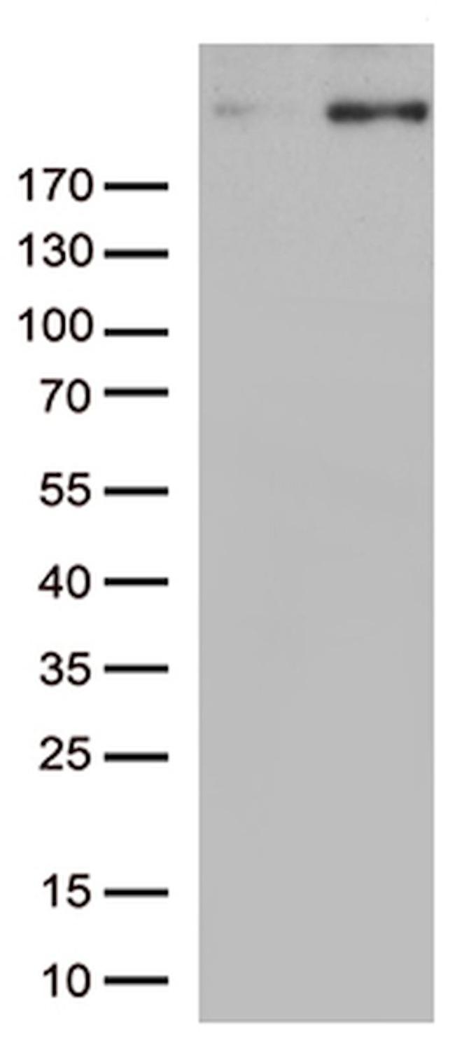 CAD Antibody in Western Blot (WB)