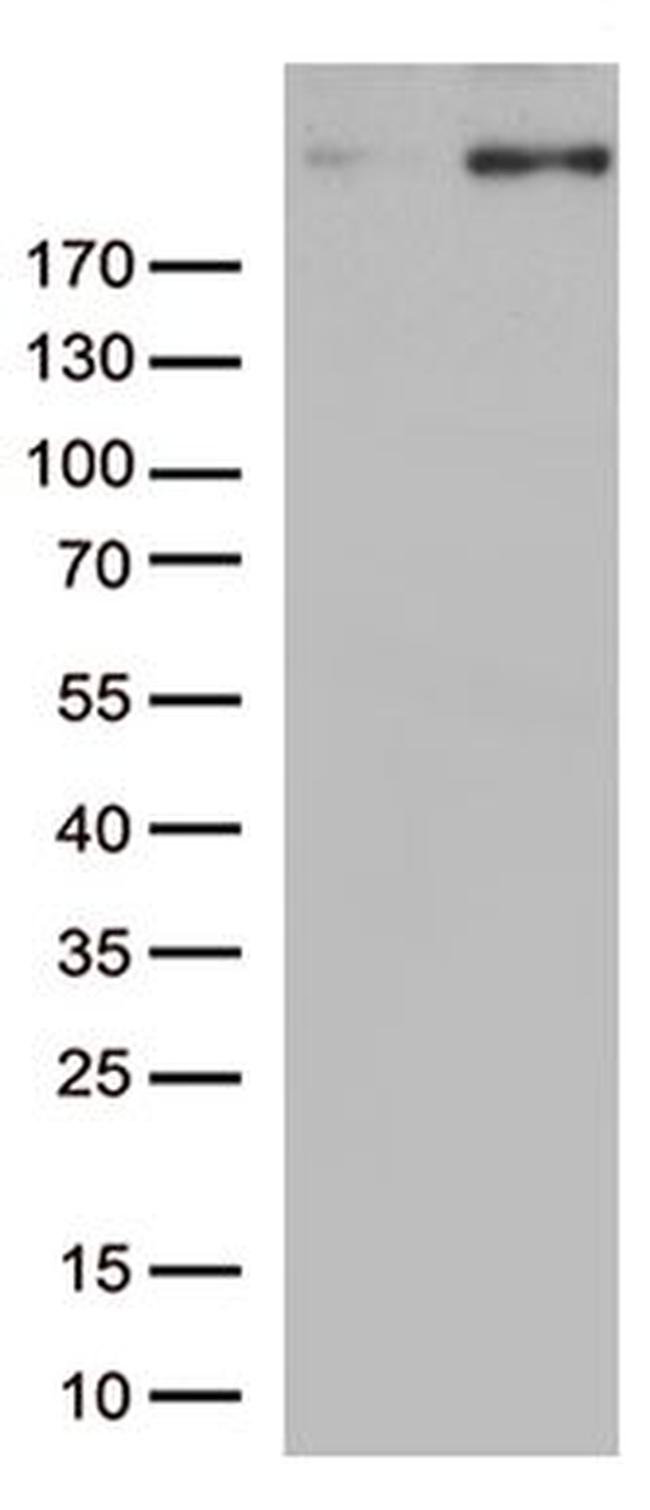 CAD Antibody in Western Blot (WB)