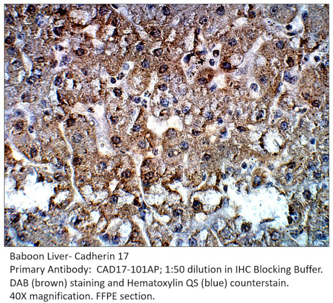 Cadherin 17 Antibody in Immunohistochemistry (IHC)