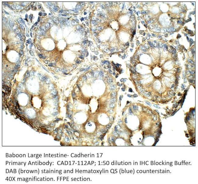 Cadherin 17 Antibody in Immunohistochemistry (IHC)