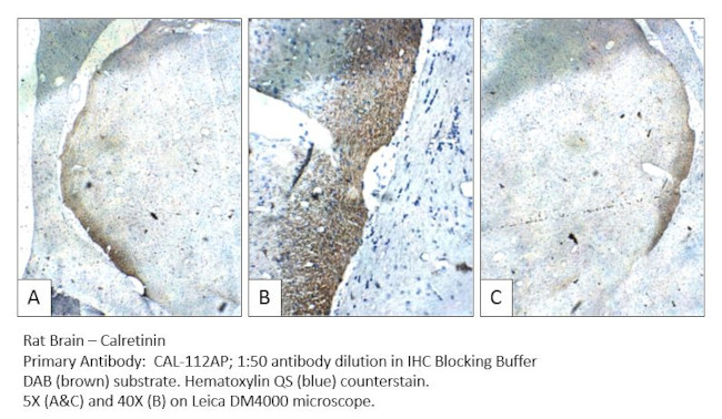 Calretinin Antibody in Immunohistochemistry (IHC)