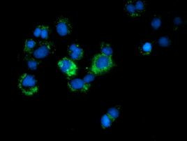 CALCOCO2 Antibody in Immunocytochemistry (ICC/IF)
