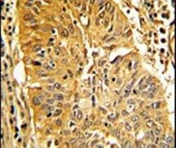 Caldesmon Antibody in Immunohistochemistry (IHC)