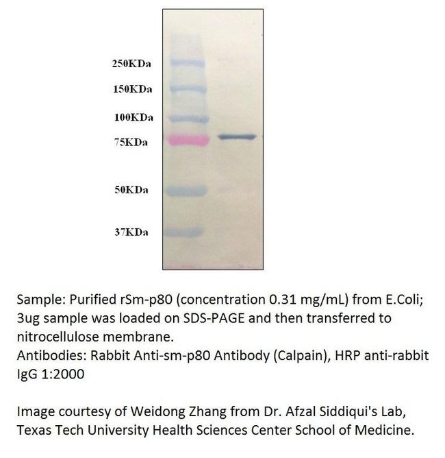 Calpain Antibody in Western Blot (WB)