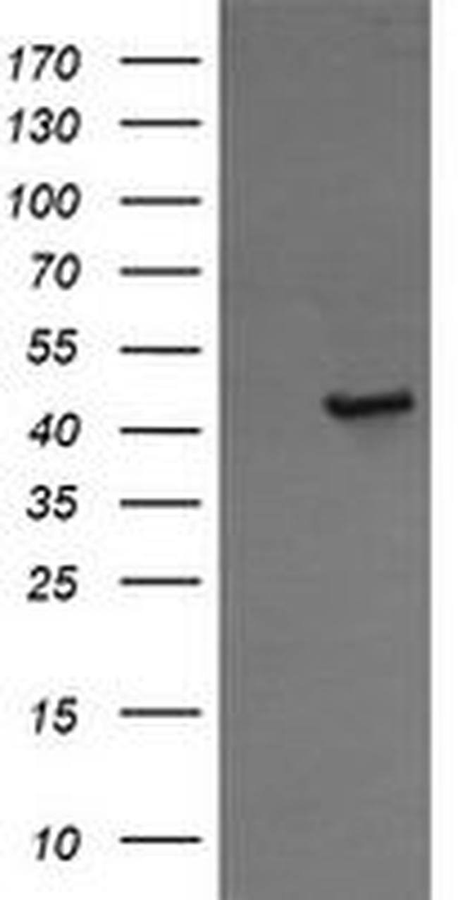 CALR3 Antibody in Western Blot (WB)