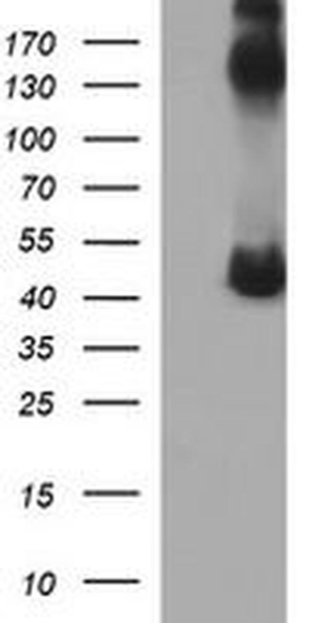 CALR3 Antibody in Western Blot (WB)